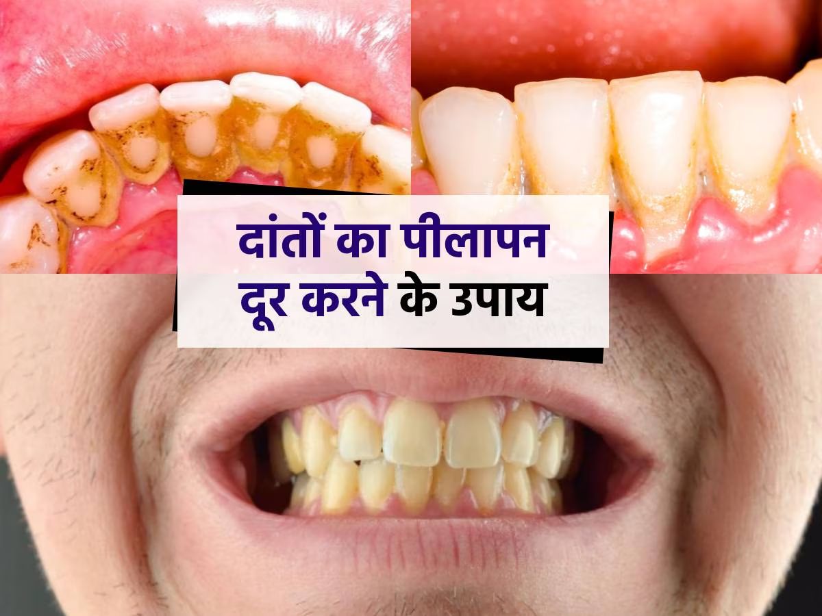 Anti-aging foods: बढ़ती उम्र को कहना है अलविदा ? तो अपनी डाइट में शामिल करे ये 5 चीज़े