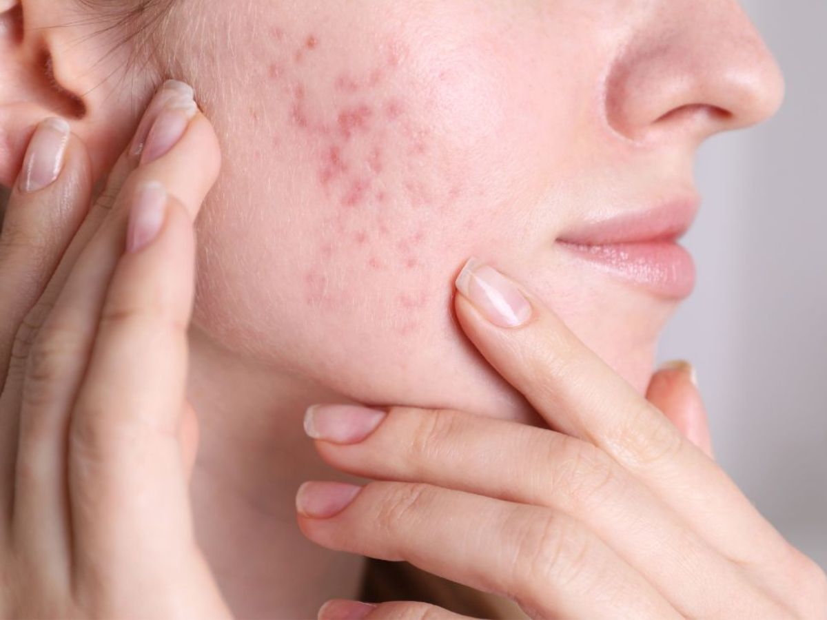 before-taking-birth-control-pills-discover-the-hidden-facts-you-need-to-know जानें बर्थ कंट्रोल गोलियों के बारे में कुछ ख़ास बातें, क्या आपकी सेहत को हैं इससे खतरा ? - Photo Gallery