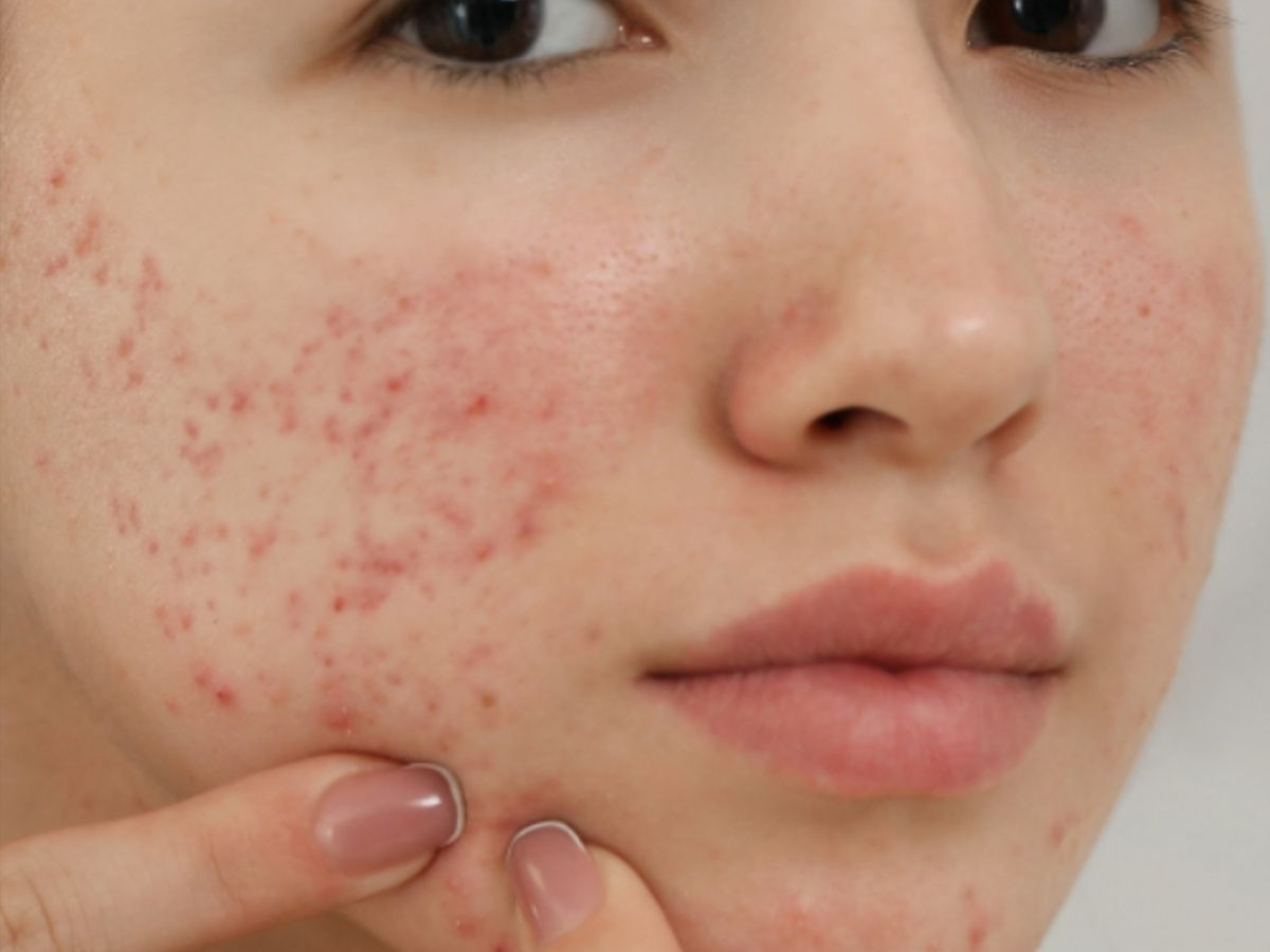 disadvantages-of-contraceptive-pills-which-effect-our-health-and-problem-like-vomiting-increasing-fat Disadvantages Of Contraceptive Pills:कांट्रेसेप्टिव पिल्स के नुकसान,जिससे आपकी बॉडी पर हो सकते है ये सारे इफेक्ट - Photo Gallery