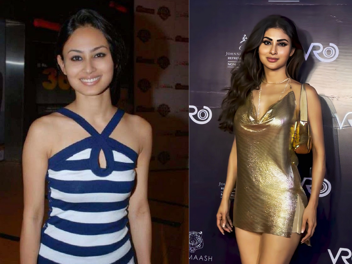 खूबसूरत बनने के चक्कर में इन पॉपुलर एक्ट्रेसेस ने कराई प्लास्टिक सर्जरी, चेहरा हुआ और भी खराब अब दिखती हैं ऐसी - Photo Gallery