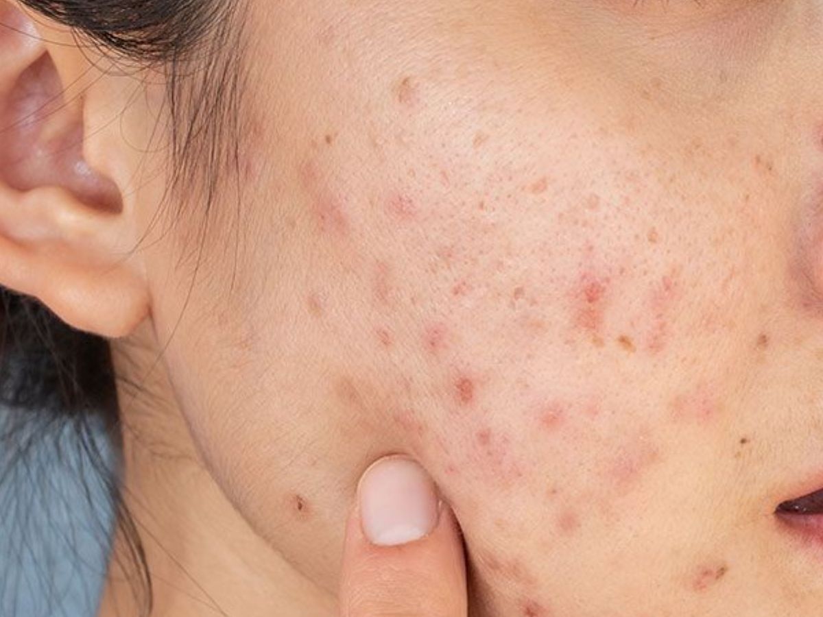 Glowing Skin के लिए इस्तेमाल कर सकते हैं Rice Water, कुछ ही दिनों में दिखने लगेगा असर,नहीं पड़ेगी कभी मेकअप की जरूरत - Photo Gallery