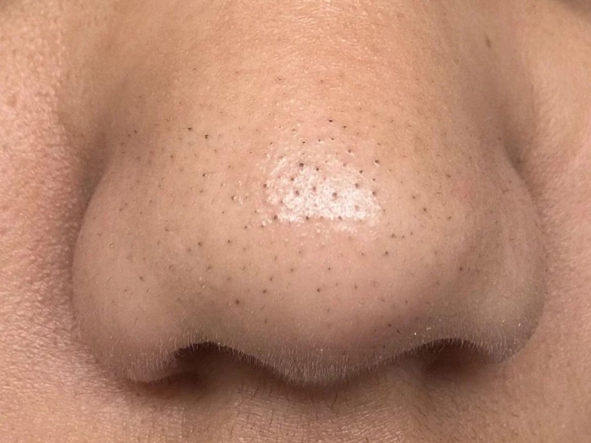 झुर्रियाँ, मुंहासों और ड्राई स्किन से पाए छुटकारा, रात भर Aloe Vera जेल लगाने से मिलेगी नेचुरल ग्लोइंग स्किन