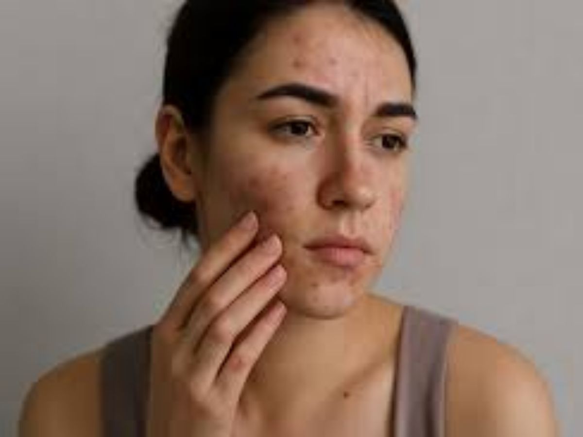 Blackheads हटाने का सबसे आसान तरीका, ना चाहिए होगा मास्क ना स्क्रब जरूरत होगी तो सिर्फ गर्म तौलिये की - Photo Gallery