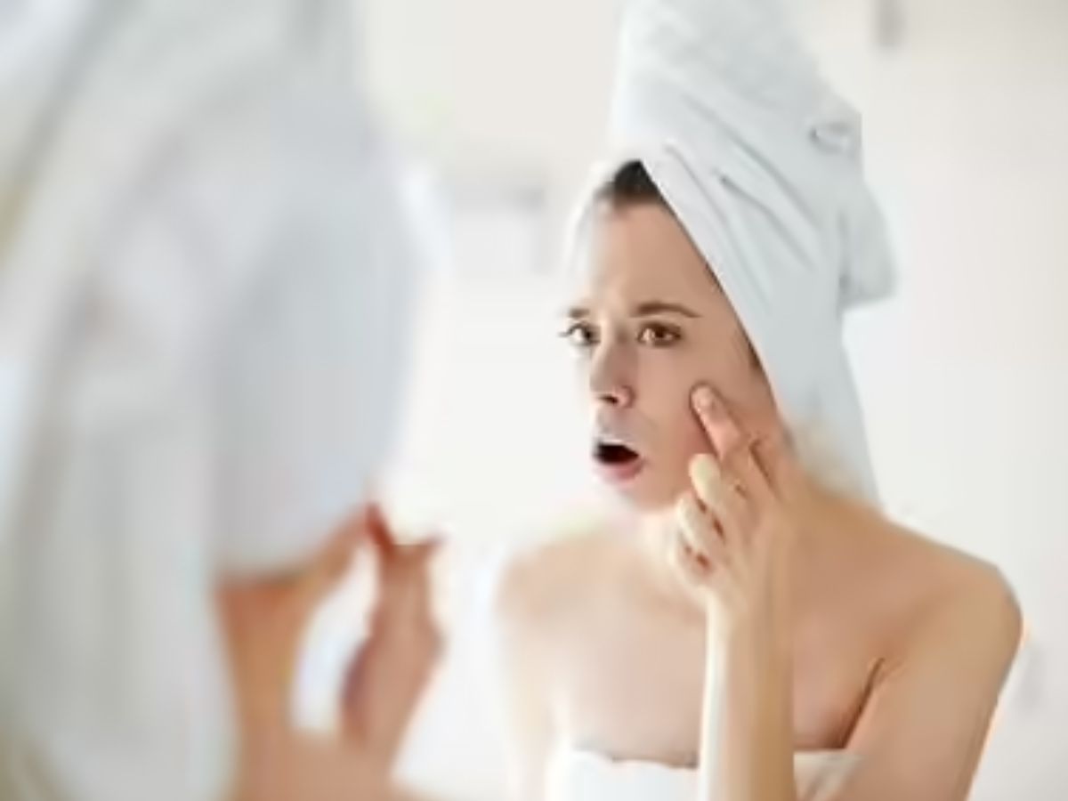 Blackheads हटाने का सबसे आसान तरीका, ना चाहिए होगा मास्क ना स्क्रब जरूरत होगी तो सिर्फ गर्म तौलिये की - Photo Gallery